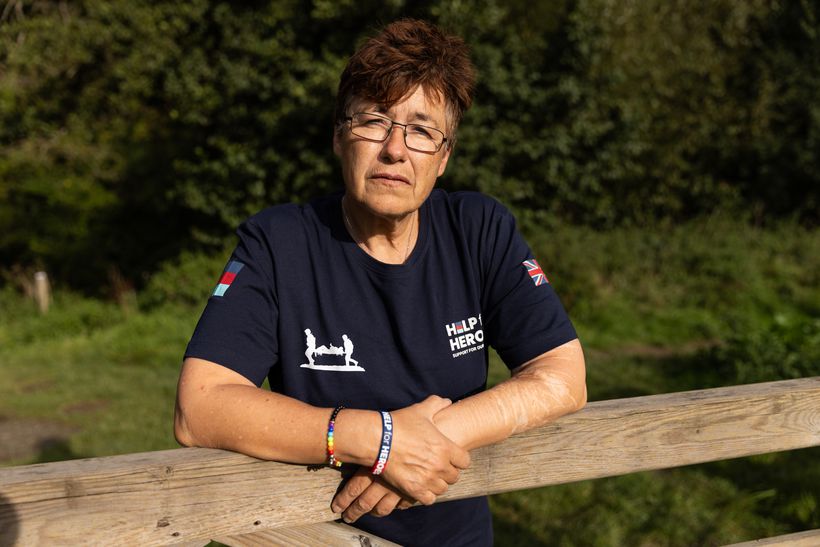 Jean looking solemn showing her scars